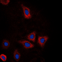 DDX3 / DDX3X Antibody - Immunofluorescent analysis of DDX3X staining in HepG2 cells. Formalin-fixed cells were permeabilized with 0.1% Triton X-100 in TBS for 5-10 minutes and blocked with 3% BSA-PBS for 30 minutes at room temperature. Cells were probed with the primary antibody in 3% BSA-PBS and incubated overnight at 4 ??C in a humidified chamber. Cells were washed with PBST and incubated with a DyLight 594-conjugated secondary antibody (red) in PBS at room temperature in the dark. DAPI was used to stain the cell nuclei (blue).
