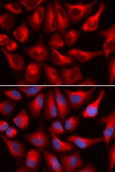 DDX3 / DDX3X Antibody - Immunofluorescence analysis of U20S cells.
