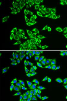 DDX3 / DDX3X Antibody - Immunofluorescence analysis of HeLa cells.