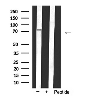DDX3 / DDX3X Antibody - Western blot analysis of DDX3/DEAD box Protein 3 expression in HepG2 cells