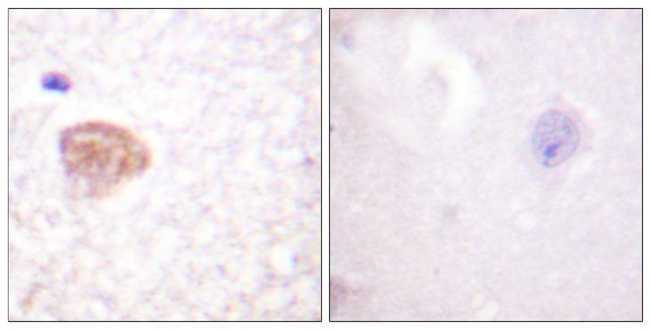 DDX3 / DDX3X Antibody - Peptide - + Immunohistochemistry analysis of paraffin-embedded human brain tissue using DDX3/DEAD-box Protein 3 (Ab-322) antibody.