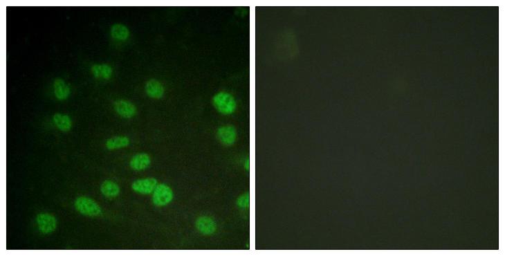 DDX3 / DDX3X Antibody - Immunofluorescence analysis of HUVEC cells treated with serum 20% 30', using DDX3/DEAD-box Protein 3 (Phospho-Thr322) Antibody. The picture on the right is blocked with the phospho peptide.