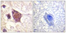 DDX3 / DDX3X Antibody - Immunohistochemistry analysis of paraffin-embedded human brain, using DDX3/DEAD-box Protein 3 (Phospho-Thr322) Antibody. The picture on the right is blocked with the phospho peptide.