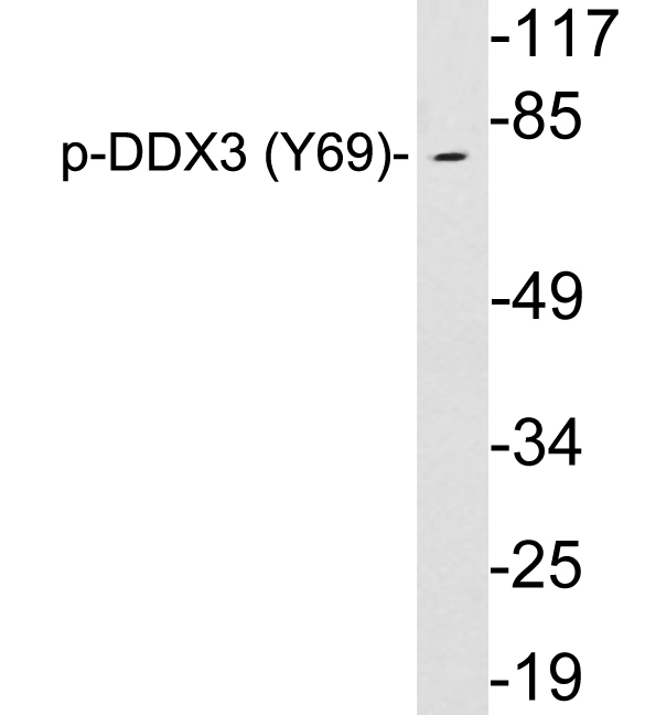 DDX3 / DDX3X Antibody - Western blot analysis of lysates from HepG2 cells, using phospho-DDX3 (Phospho-Tyr69) antibody.