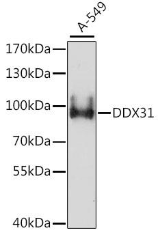 DDX31 Antibody - Western blot analysis of extracts of A-549 cells using DDX31 Polyclonal Antibody at dilution of 1:1000.