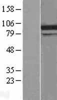 DDX31 Protein - Western validation with an anti-DDK antibody * L: Control HEK293 lysate R: Over-expression lysate