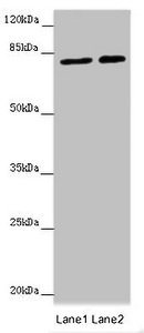 DDX33 / DHX33 Antibody - Western blot All Lanes : DHX33 antibody at 16 ug/ml Lane 1 : Hela whole cell lysate Lane 2 : 293T whole cell lysate Secondary Goat polyclonal to rabbit IgG at 1/10000 dilution Predicted band size: 79,61 kDa Observed band size: 79 kDa