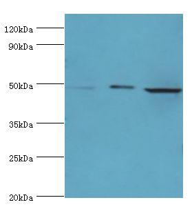 DDX39 Antibody - Western blot. All lanes: ATP-dependent RNA helicase DDX39A antibody at 2 ug/ml. Lane 1: A431 whole cell lysate. Lane 2: 293T whole cell lysate. Lane 3: HepG2 whole cell lysate. secondary Goat polyclonal to rabbit at 1:10000 dilution. Predicted band size: 49 kDa. Observed band size: 49 kDa.