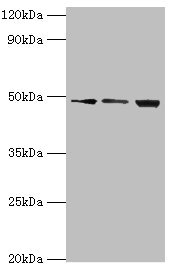 DDX39 Antibody - Western blot All lanes: ATP-dependent RNA helicase DDX39A antibody at 2µg/ml Lane 1: A431 whole cell lysate Lane 2: 293T whole cell lysate Lane 3: HepG2 whole cell lysate Secondary Goat polyclonal to rabbit IgG at 1/10000 dilution Predicted band size: 50, 37, 31 kDa Observed band size: 50 kDa