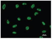 DDX39 Antibody - Immunofluorescent staining using DDX39 antibody. Immunostaining analysis in HeLa cells. HeLa cells were fixed with 4% paraformaldehyde and permeabilized with 0.01% Triton-X100 in PBS. The cells were immunostained with anti-DDX39 antibody.
