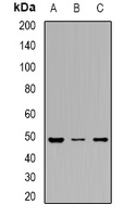 DDX39 Antibody - Western blot analysis of DDX39A expression in HepG2 (A); Jurkat (B); rat brain (C) whole cell lysates.