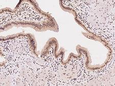 DDX39 Antibody - Immunochemical staining of human DDX39A in human gallbladder with rabbit polyclonal antibody at 1:100 dilution, formalin-fixed paraffin embedded sections.