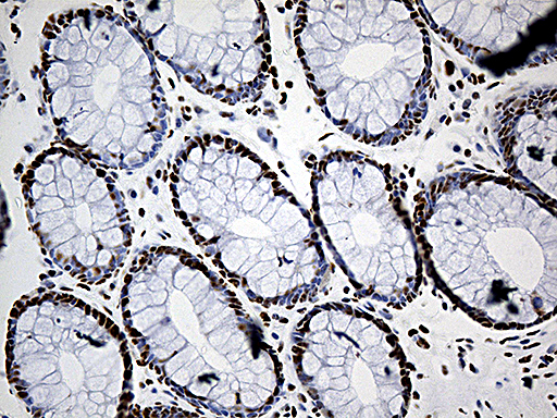 DDX39B / UAP56 Antibody - Immunohistochemical staining of paraffin-embedded Human colon tissue within the normal limits using anti-DDX39B mouse monoclonal antibody. (Heat-induced epitope retrieval by 1mM EDTA in 10mM Tris buffer. (pH8.5) at 120°C for 3 min. (1:500)