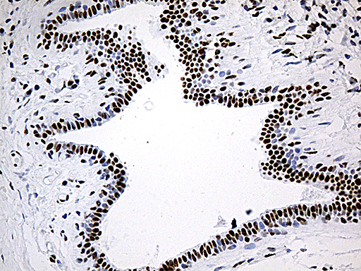 DDX39B / UAP56 Antibody - Immunohistochemical staining of paraffin-embedded Human breast tissue within the normal limits using anti-DDX39B mouse monoclonal antibody. (Heat-induced epitope retrieval by 1mM EDTA in 10mM Tris buffer. (pH8.5) at 120°C for 3 min. (1:500)