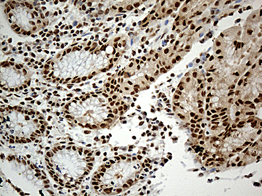 DDX39B / UAP56 Antibody - Immunohistochemical staining of paraffin-embedded Human gastric tissue within the normal limits using anti-DDX39B mouse monoclonal antibody. (Heat-induced epitope retrieval by 1mM EDTA in 10mM Tris buffer. (pH8.5) at 120°C for 3 min. (1:500)