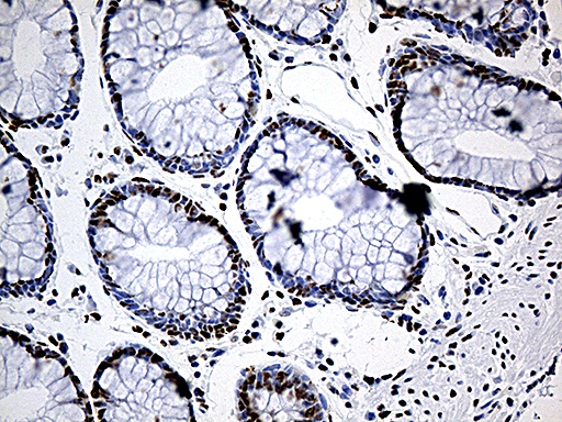 DDX39B / UAP56 Antibody - Immunohistochemical staining of paraffin-embedded Human colon tissue within the normal limits using anti-DDX39B mouse monoclonal antibody. (Heat-induced epitope retrieval by 1mM EDTA in 10mM Tris buffer. (pH8.5) at 120°C for 3 min. (1:500)