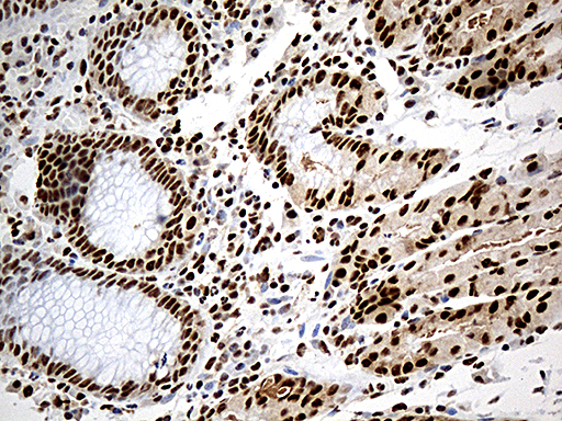DDX39B / UAP56 Antibody - Immunohistochemical staining of paraffin-embedded Human bladder tissue within the normal limits using anti-DDX39B mouse monoclonal antibody. (Heat-induced epitope retrieval by 1mM EDTA in 10mM Tris buffer. (pH8.5) at 120°C for 3 min. (1:500)