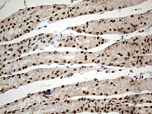 DDX39B / UAP56 Antibody - Immunohistochemical staining of paraffin-embedded Human bladder tissue within the normal limits using anti-DDX39B mouse monoclonal antibody. (Heat-induced epitope retrieval by 1mM EDTA in 10mM Tris buffer. (pH8.5) at 120°C for 3 min. (1:500)