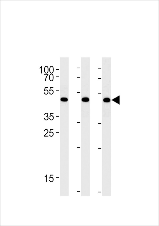 DDX39B / UAP56 Antibody - BAT1 Antibody western blot of A431,HeLa,Jurkat cell line lysates (35 ug/lane). The BAT1 antibody detected the BAT1 protein (arrow).