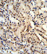 DDX39B / UAP56 Antibody - Formalin-fixed and paraffin-embedded human kidney reacted with BAT1 Antibody , which was peroxidase-conjugated to the secondary antibody, followed by DAB staining. This data demonstrates the use of this antibody for immunohistochemistry; clinical relevance has not been evaluated.
