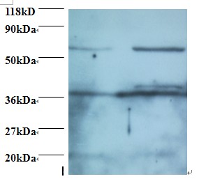 DDX39B / UAP56 Antibody - Western blot of Spliceosome RNA helicase DDX39B antibody at 2 ug/ml. Lane 1: EC109 whole cell lysate. Lane 2: 293T whole cell lysate. Secondary: Goat polyclonal to Rabbit IgG at 1:15000 dilution. Predicted band size: 47 kDa. Observed band size: 40 kDa Additional bands at: 60 kDa. We are unsure as to the identity of this extra band.  This image was taken for the unconjugated form of this product. Other forms have not been tested.