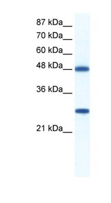 DDX39B / UAP56 Antibody - DDX39B / UAP56 antibody Western blot of Jurkat lysate. This image was taken for the unconjugated form of this product. Other forms have not been tested.
