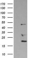 DDX39B / UAP56 Antibody - HEK293T cells were transfected with the pCMV6-ENTRY control (Left lane) or pCMV6-ENTRY BAT1 (Right lane) cDNA for 48 hrs and lysed. Equivalent amounts of cell lysates (5 ug per lane) were separated by SDS-PAGE and immunoblotted with anti-BAT1.