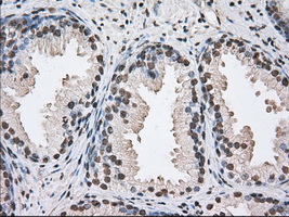 DDX39B / UAP56 Antibody - IHC of paraffin-embedded Human prostate tissue using anti-BAT1 mouse monoclonal antibody. (Dilution 1:50).