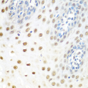 DDX39B / UAP56 Antibody - Immunohistochemistry of paraffin-embedded human esophagus.