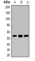 DDX39B / UAP56 Antibody - Western blot analysis of DDX39B expression in HeLa (A); SKOV3 (B); K562 (C) whole cell lysates.