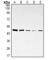 DDX39B / UAP56 Antibody - Western blot analysis of DDX39B expression in HepG2 (A), K562 (B), Jurkat (C), NIH3T3 (D), MCF7 (E) whole cell lysates.