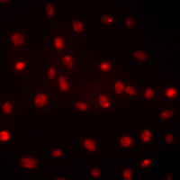 DDX39B / UAP56 Antibody - Immunofluorescent analysis of DDX39B staining in Hela cells. Formalin-fixed cells were permeabilized with 0.1% Triton X-100 in TBS for 5-10 minutes and blocked with 3% BSA-PBS for 30 minutes at room temperature. Cells were probed with the primary antibody in 3% BSA-PBS and incubated overnight at 4 °C in a humidified chamber. Cells were washed with PBST and incubated with a DyLight 594-conjugated secondary antibody (red) in PBS at room temperature in the dark.