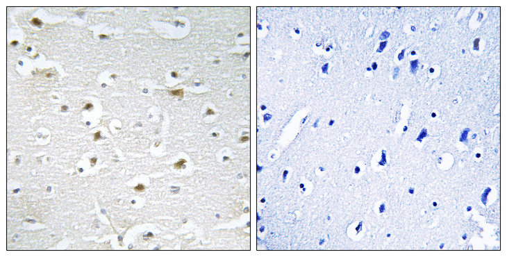 DDX3Y Antibody - Immunohistochemistry analysis of paraffin-embedded human brain tissue, using DDX3Y Antibody. The picture on the right is blocked with the synthesized peptide.