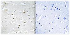 DDX3Y Antibody - Immunohistochemistry analysis of paraffin-embedded human brain tissue, using DDX3Y Antibody. The picture on the right is blocked with the synthesized peptide.