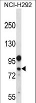 DDX3Y Antibody - DDX3Y Antibody western blot of NCI-H292 cell line lysates (35 ug/lane). The DDX3Y antibody detected the DDX3Y protein (arrow).