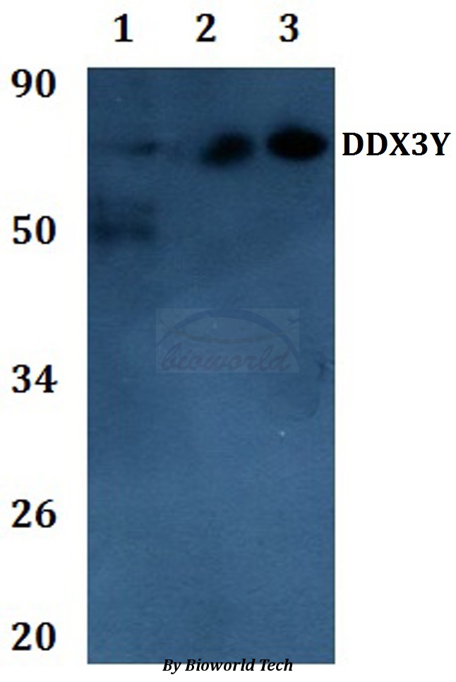DDX3Y Antibody - Western blot of DDX3Y antibody at 1:500 dilution Line1:THP-1 whole cell lysate Line2:PC12 whole cell lysate Line3:sp20 whole cell lysate.