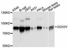 DDX3Y Antibody - Western blot analysis of extracts of various cell lines, using DDX3Y antibody at 1:3000 dilution. The secondary antibody used was an HRP Goat Anti-Rabbit IgG (H+L) at 1:10000 dilution. Lysates were loaded 25ug per lane and 3% nonfat dry milk in TBST was used for blocking. An ECL Kit was used for detection and the exposure time was 1s.