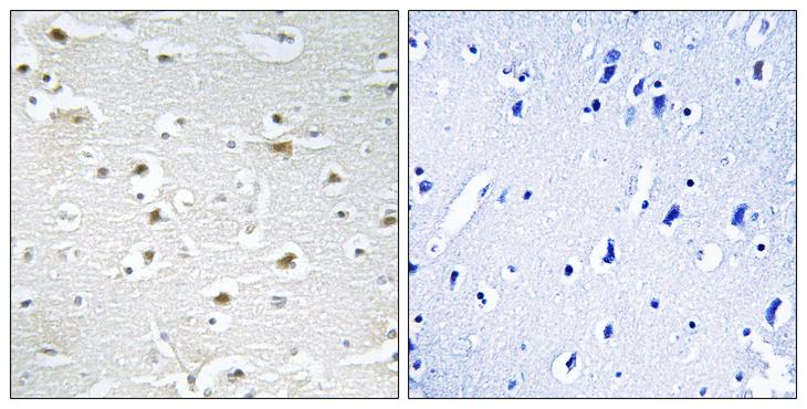 DDX3Y Antibody - Peptide - + Immunohistochemistry analysis of paraffin-embedded human brain tissue using DDX3Y antibody.