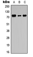 DDX3Y Antibody - Western blot analysis of DDX3Y expression in THP1 (A); NS-1 (B); PC12 (C) whole cell lysates.