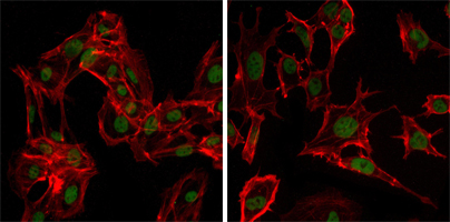 DDX4 / VASA Antibody - Immunofluorescence of MSCs(left) and NTERA-2 (right) cells using DDX4 mouse monoclonal antibody (green). Red: Actin filaments have been labeled with DY-554 phalloidin.