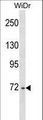 DDX4 / VASA Antibody - DDX4 Antibody western blot of WiDr cell line lysates (35 ug/lane). The DDX4 antibody detected the DDX4 protein (arrow).