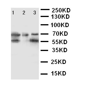 DDX4 / VASA Antibody - WB of DDX4 / VASA antibody. Lane 1: Rat Testis Tissue Lysate. Lane 2: Mouse Testis Tissue Lysate. Lane 3: HELA Cell Lysate.
