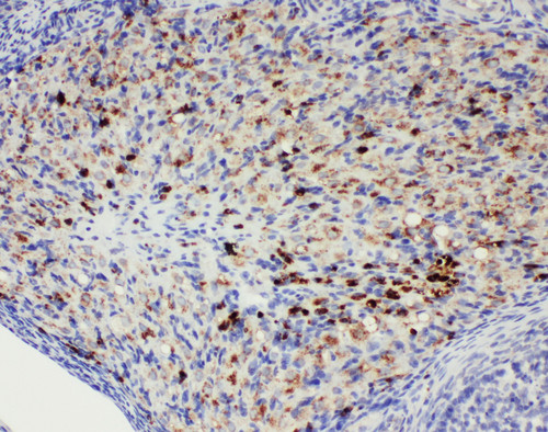 DDX4 / VASA Antibody - DDX4 / VASA antibody. IHC(P): Rat Ovary Tissue.
