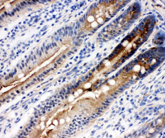 DDX4 / VASA Antibody - DDX4 / VASA antibody. IHC(F): Rat Intestine Tissue.