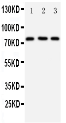 DDX4 / VASA Antibody - Anti-DDX4/MVH antibody, Western blotting Lane 1: Rat Testis Tissue LysateLane 2: Mouse Testis Tissue LysateLane 3: HELA Cell Lysate