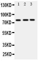 DDX4 / VASA Antibody - Anti-DDX4/MVH antibody, Western blotting Lane 1: Rat Testis Tissue LysateLane 2: Mouse Testis Tissue LysateLane 3: Mouse Ovary Tissue Lysate
