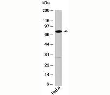 DDX4 / VASA Antibody - DDX4 antibody western blot with human samples