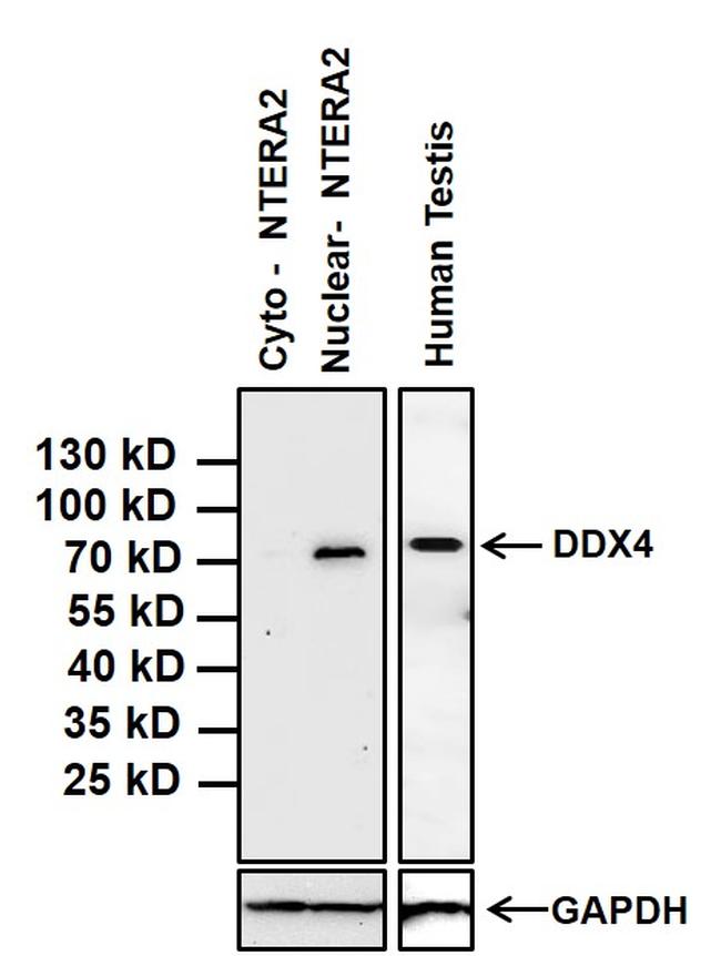 DDX4 / VASA Antibody - DDX4 Antibody in Western Blot (WB)