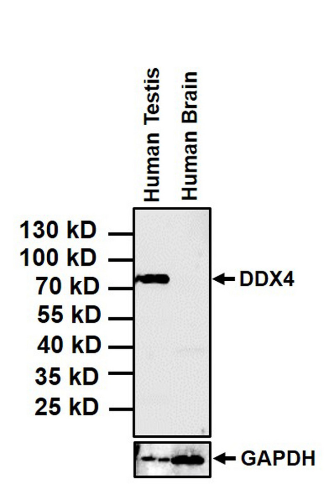 DDX4 / VASA Antibody - DDX4 Antibody in Western Blot (WB)