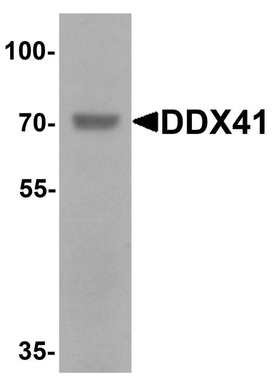 DDX41 / ABS Antibody - Western blot analysis of DDX41 in rat brain tissue lysate with DDX41 antibody at 1 ug/ml.